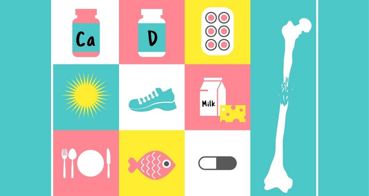 «Αυτή είναι η οστεοπόρωση» – Το μήνυμα της Παγκόσμιας Ημέρας 2020 και διατροφικά tips